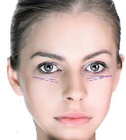 nici Derma Spring Eye 02